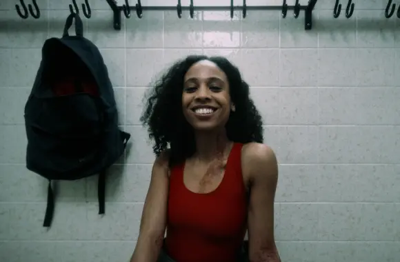 Du bist unaufhaltsam mit deiner Neurodermitis